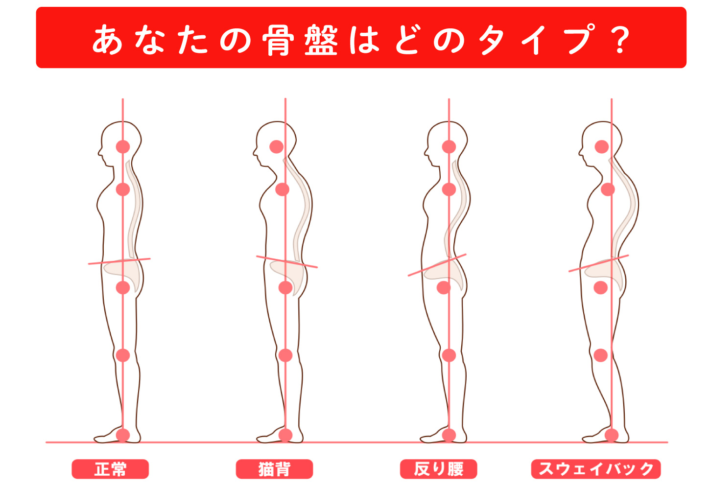 あなたの骨盤はどのタイプ？
